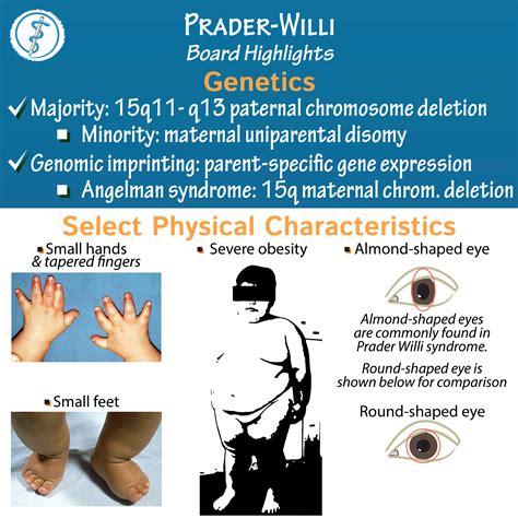 prada willy|prader willi disease nhs.